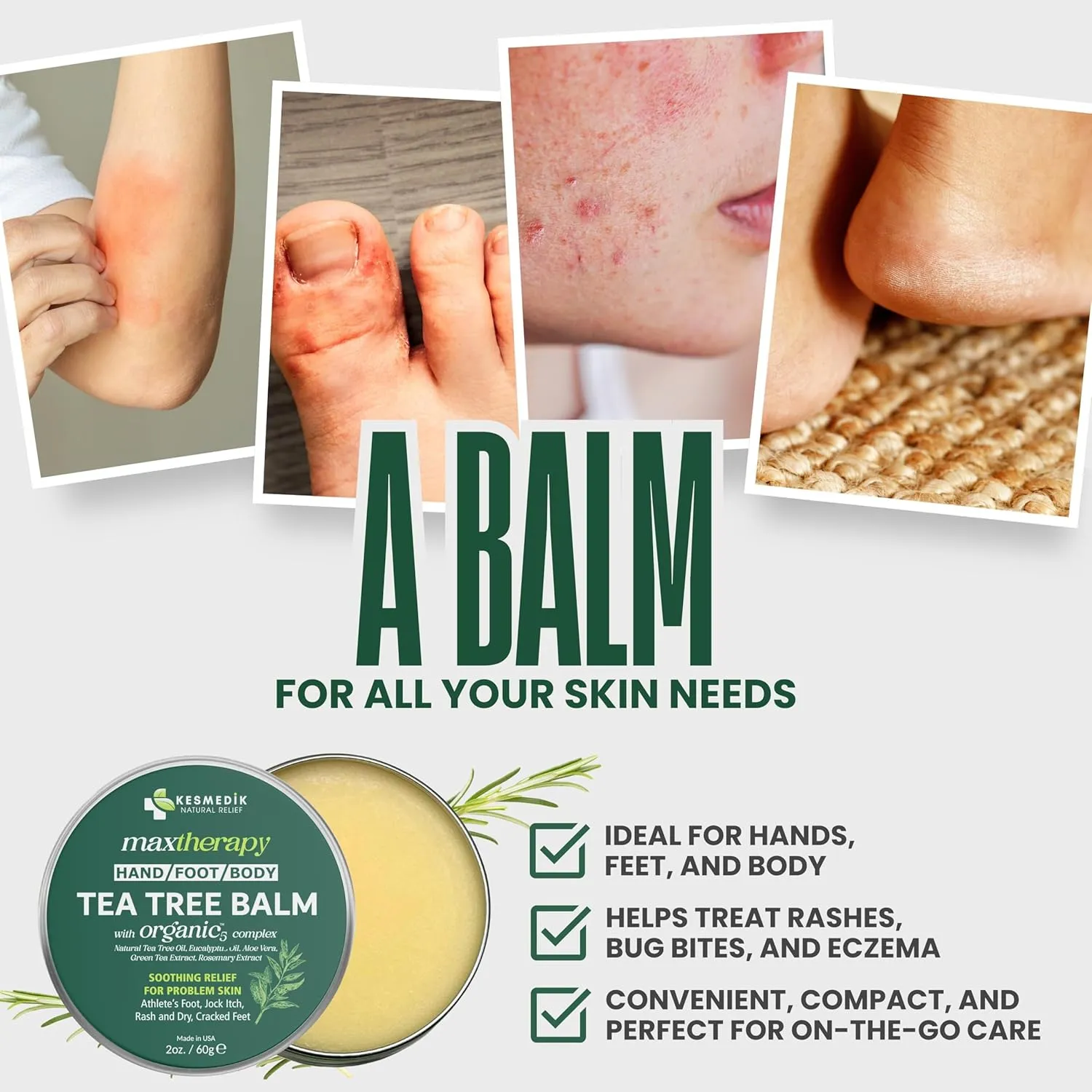Tea Tree Oil Balm MaxTherapy | Botanical Ointment for Feet, Scalp & Body, Soothes Itchy Skin, Rashes, Softens Dryness & Cracked Skin, Gentle & Effective for All Ages (2-Pack)